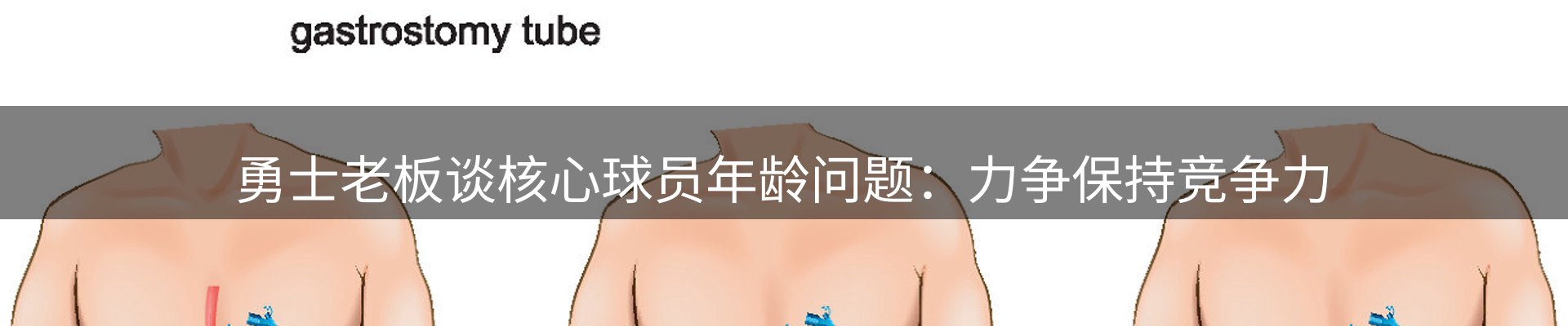 体育资讯
